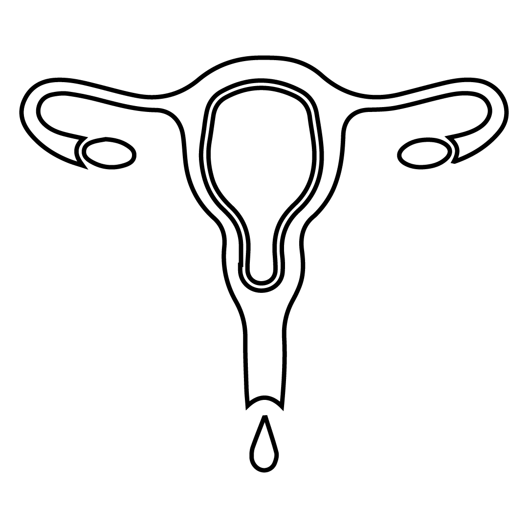 Leucorrhoea